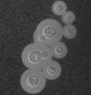 Titan cells